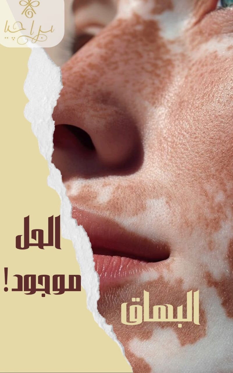 علاج الأمراض الجلدية بجهاز الإكزايمر - عيادة براجيا للتجميل والليزر