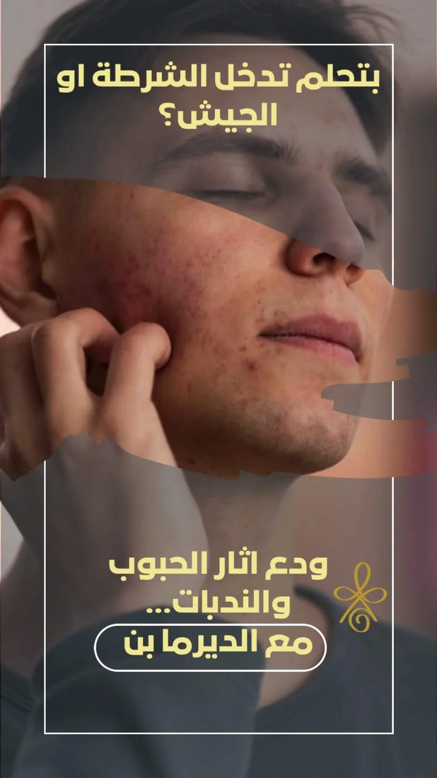 جلسات الديرما بن للبشرة والشعر - عيادة براجيا للتجميل والليزر