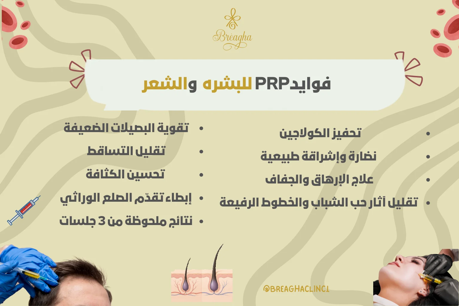 إبر البلازما (PRP) للبشرة والشعر - عيادة براجيا للتجميل والليزر